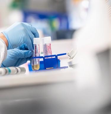 Scientist wearing gloves puts test tubes in a holder
